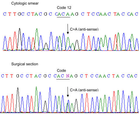 Accuracy Of Cytology Specimen And Needle Core Biopsies For Detection Of