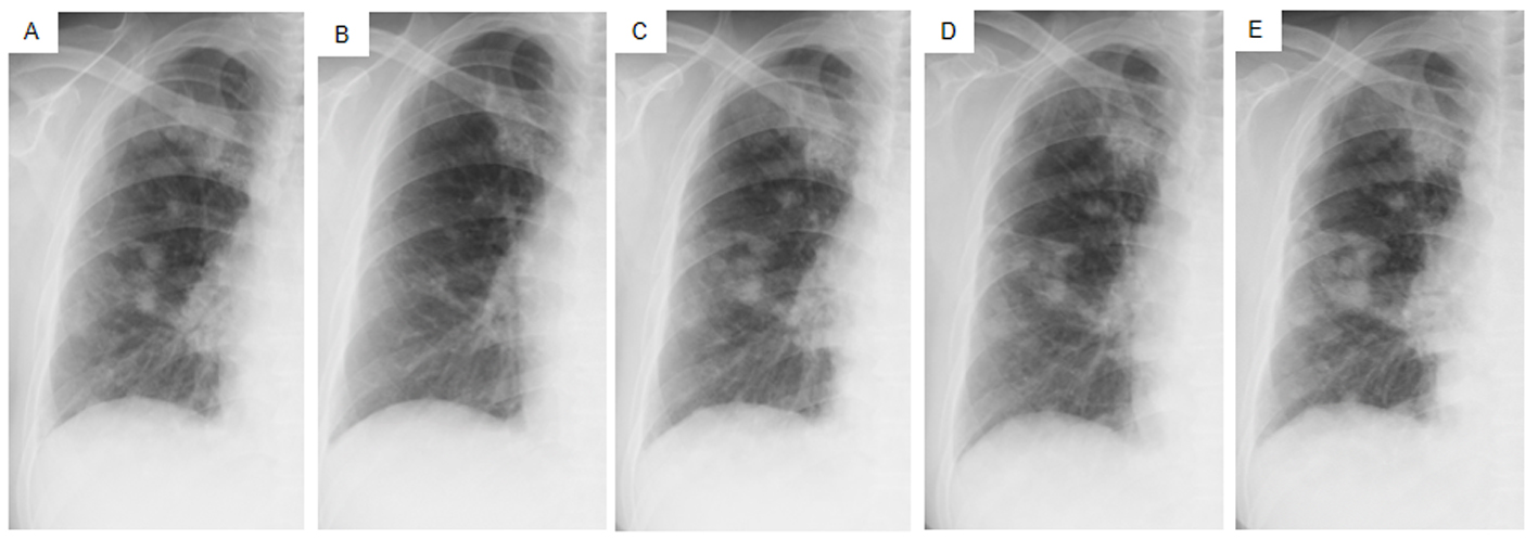 Figure 4. 